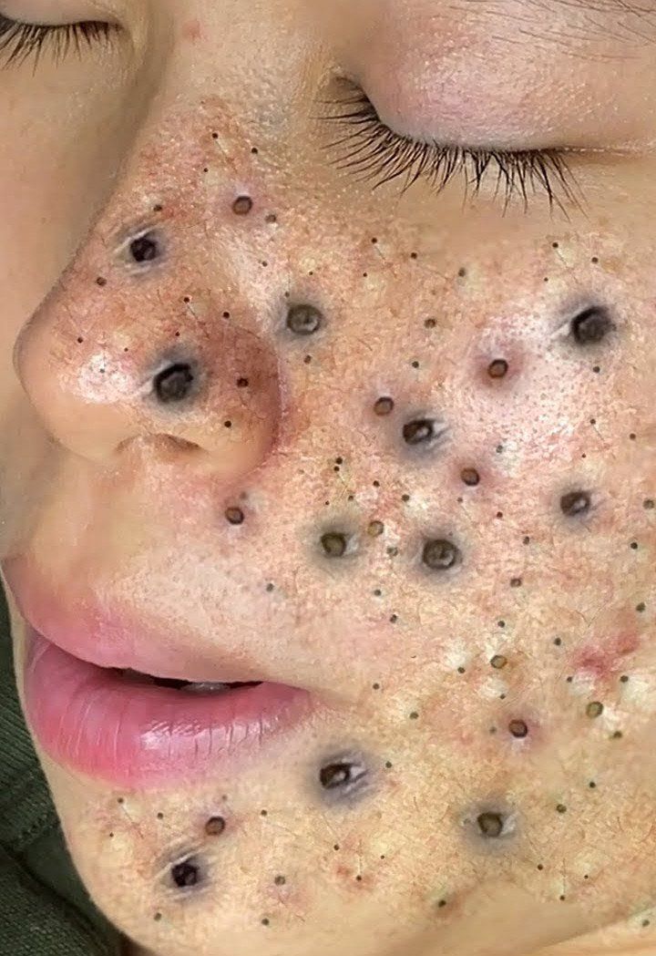 The Last of the Mohicans